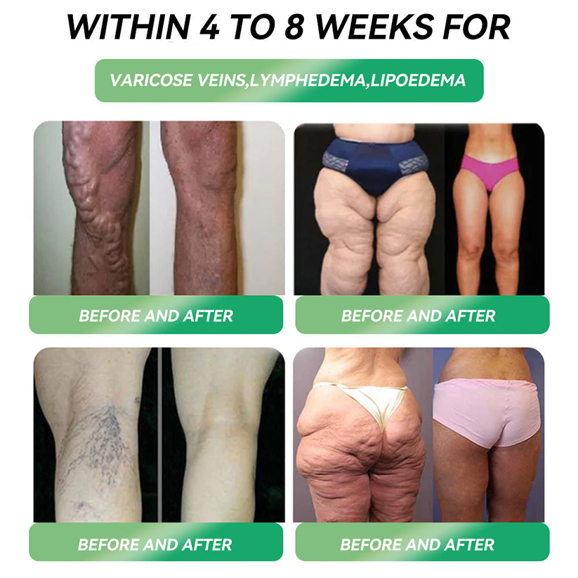 NHS 🇬🇧 Official Store 🇬🇧 | Croaie® 👩‍⚕️GLP-1 6-in-1 Health Solution Oral Solution (Only once a day, visible changes within 7 days) for obesity, cardiovascular health, diabetes, sleep apnea, intestinal health, joint problems, etc🧘